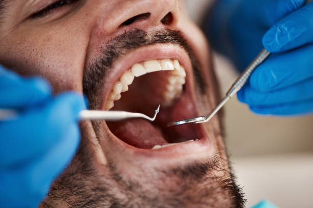 Best Cracked Tooth Emergency Dentist  in Belton, SC